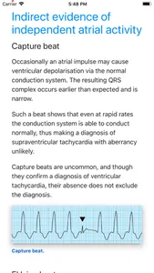 ECG Basics Lite: ECG Made Easy screenshot 4