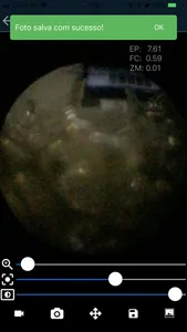 M-Scope - Mobile Endoscope screenshot 6