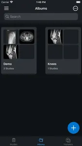 IDV - IMAIOS DICOM Viewer screenshot 1