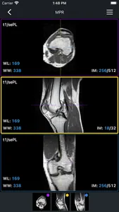 IDV - IMAIOS DICOM Viewer screenshot 4