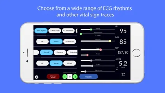 Simpl Patient Monitor screenshot 2