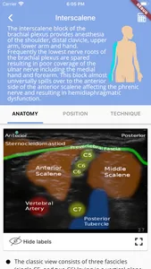 Regional Anesthesia Reference screenshot 0