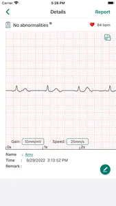 EMAY Portable ECG Monitor screenshot 2