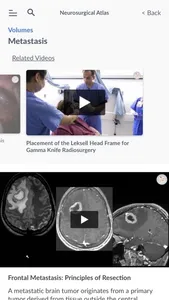 Neurosurgical Atlas screenshot 2