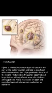 Neurosurgical Atlas screenshot 3