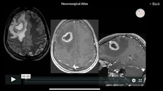 Neurosurgical Atlas screenshot 5