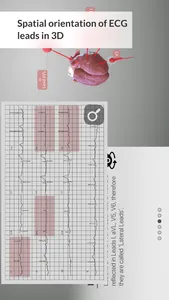 3D ECG Leads screenshot 5