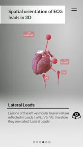 3D ECG Leads screenshot 6