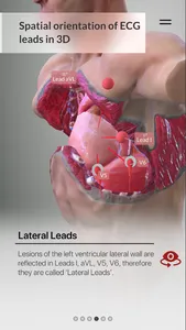 3D ECG Leads screenshot 7