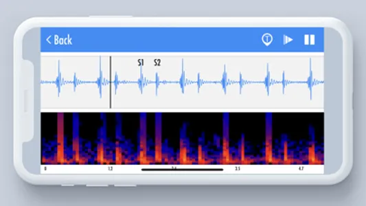 Stemoscope screenshot 2