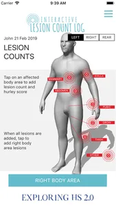 Hs Lesion Counts screenshot 1