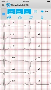 Norav Medical Mobile ECG screenshot 2