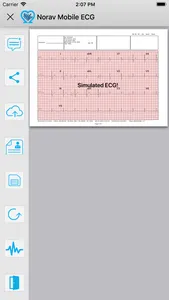 Norav Medical Mobile ECG screenshot 3