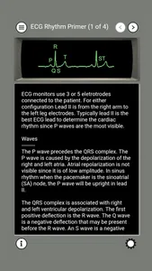 ECG Rhythms and ACLS Cases screenshot 1