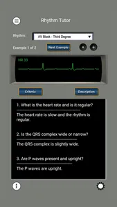 ECG Rhythms and ACLS Cases screenshot 2