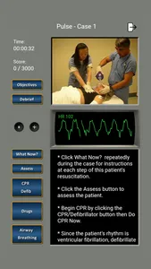 ECG Rhythms and ACLS Cases screenshot 5