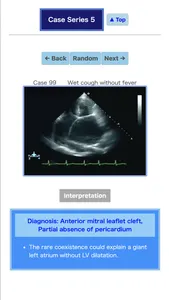Pocket Heart Echo screenshot 8