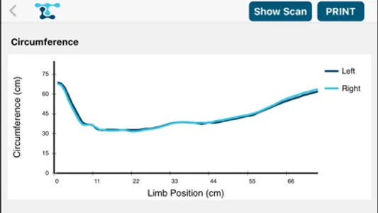 LymphaTech screenshot 3