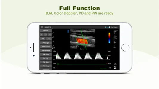 LELTEK Ultrasound - LeSono screenshot 1