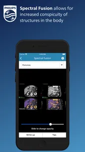 Philips CT Learning screenshot 3