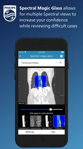 Philips CT Learning screenshot 4