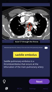 Basic Radiology screenshot 2