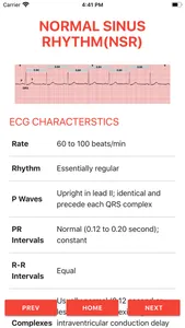 ECG FlashCards 2 screenshot 1