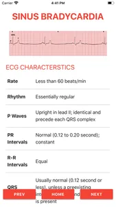 ECG FlashCards 2 screenshot 2