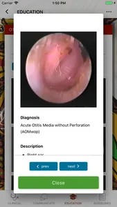 Otitis Media Guidelines screenshot 3