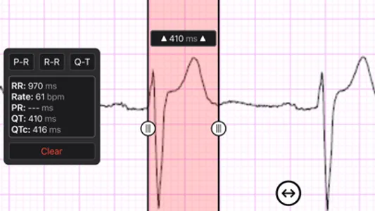 ECG Caliper screenshot 2