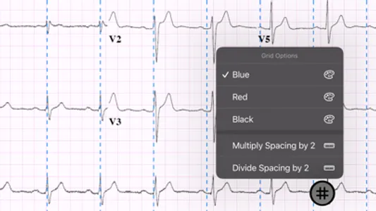 ECG Caliper screenshot 3