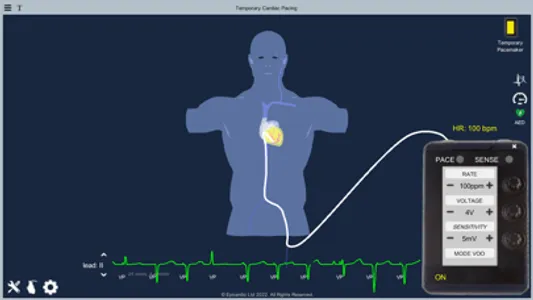 Temporary Cardiac Pacing screenshot 1