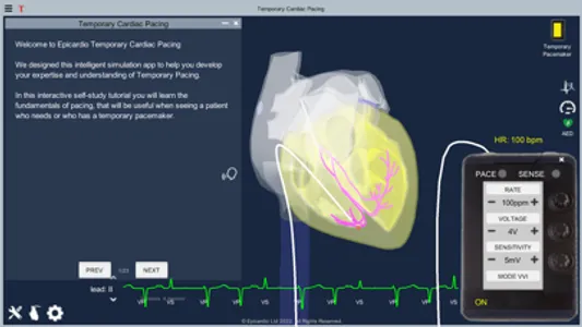 Temporary Cardiac Pacing screenshot 3