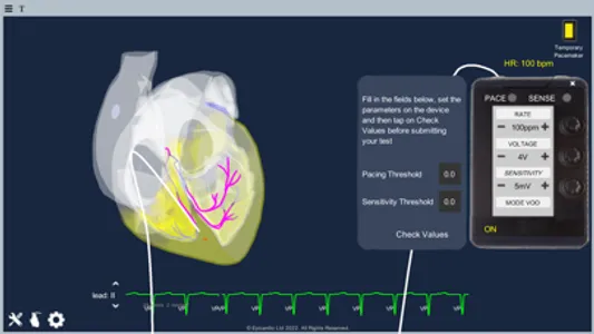 Temporary Cardiac Pacing screenshot 4