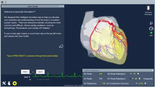 Temporary Cardiac Pacing screenshot 5