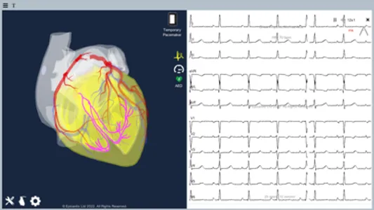 Temporary Cardiac Pacing screenshot 6