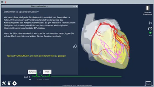 Temporary Cardiac Pacing screenshot 7