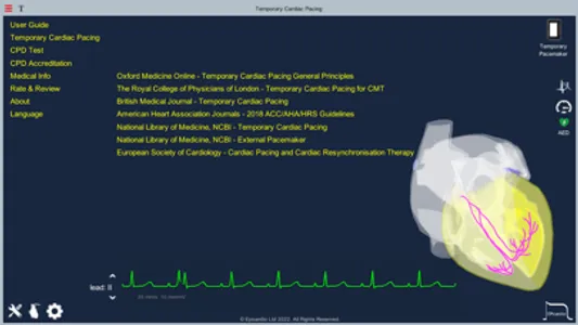 Temporary Cardiac Pacing screenshot 8