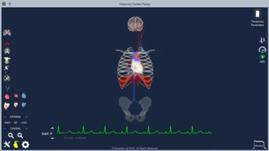 Temporary Cardiac Pacing screenshot 9