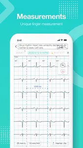 vhECG Smart screenshot 3