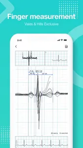 vhECG Smart screenshot 4