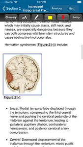 Harrison’s Manual of Med. 20/E screenshot 5