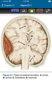 Harrison’s Manual of Med. 20/E screenshot 6