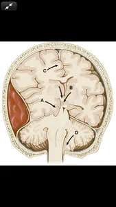 Harrison’s Manual of Med. 20/E screenshot 7