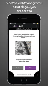 Memorix Histology QUIZ screenshot 2