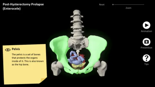 myProlapse screenshot 1