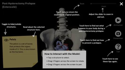 myProlapse screenshot 2