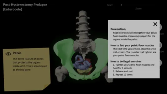 myProlapse screenshot 3