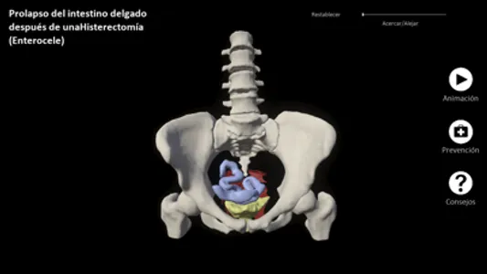 myProlapse screenshot 4