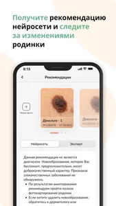 Про Родинки: здоровая кожа screenshot 3